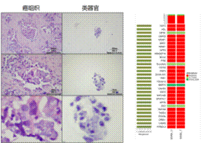 医学药筛新变革｜世界首例由实体瘤癌症患者为来源的类器官，成功筛选到临床候选药物！