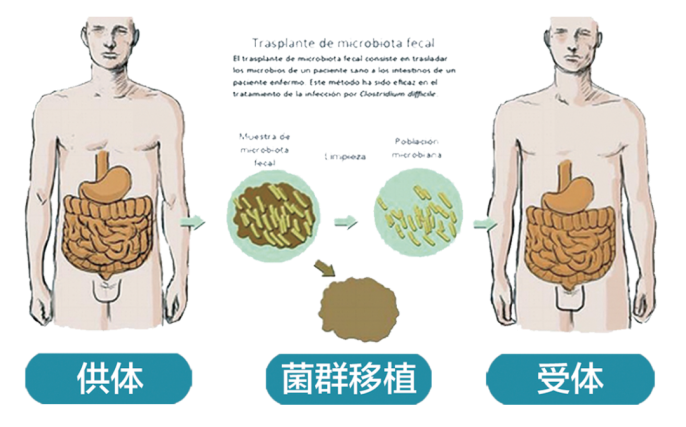 禁食减肥易诱发感染：如何使用FMT科学减肥，改善肠道？